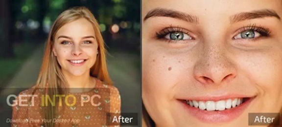 Retouch4me White Teeth Get Into Pc